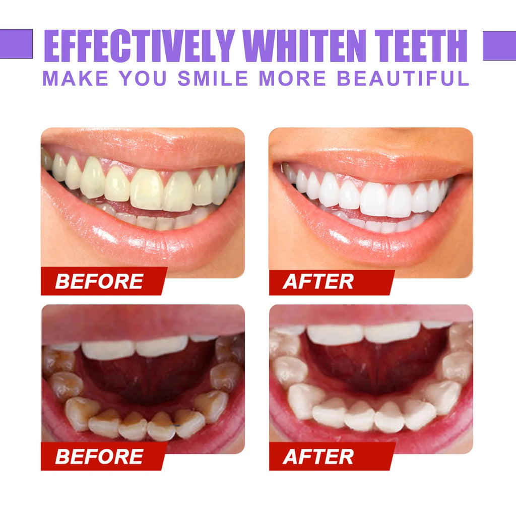 US Warehouse Wholesale Glorysmile Teeth Whitening Toothpaste 30ml Cool Mint Instant Brighten Tooth Paste